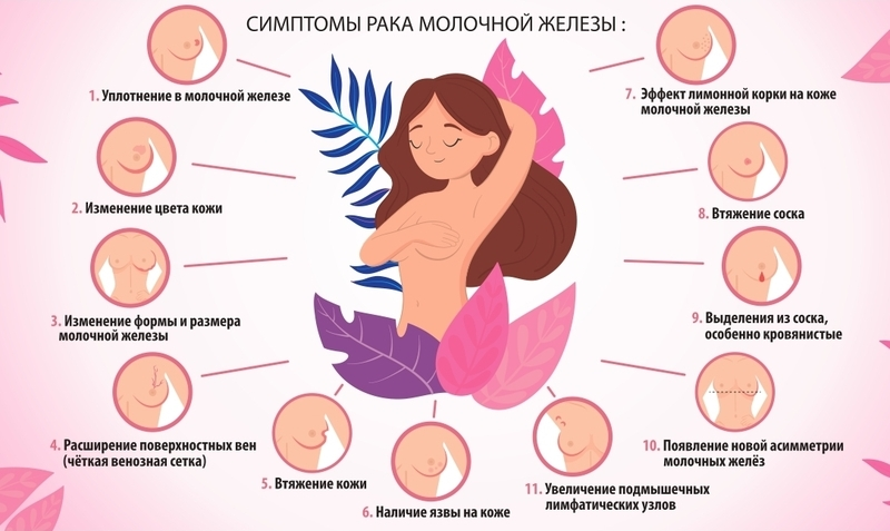 Рак молочной железы: как не пропустить тревожные сигналы