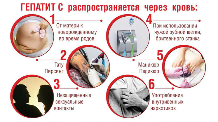 Как происходит заражение гепатитом С и как этого избежать